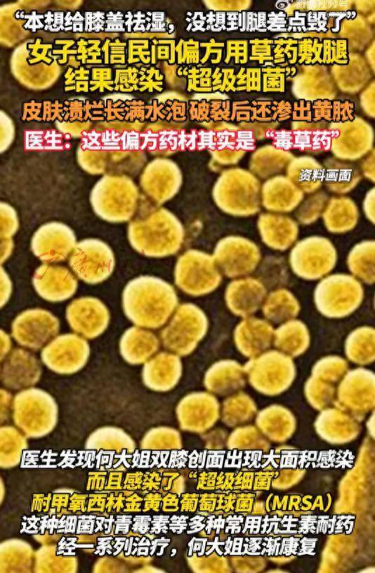 股票配资公司排行 女子听信偏方感染超级细菌，医生：有些民间偏方药材是“毒草药”